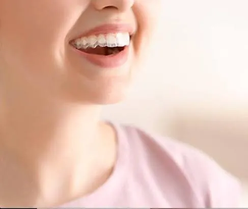 Clear aligners for teeth straightening at Revive Dental, Vajarahalli