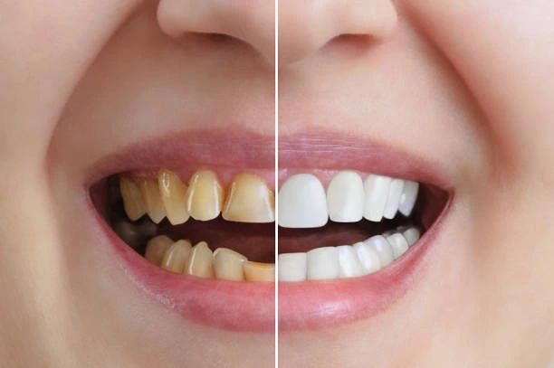 Cosmetic dentistry and smile designing at Revive Dental