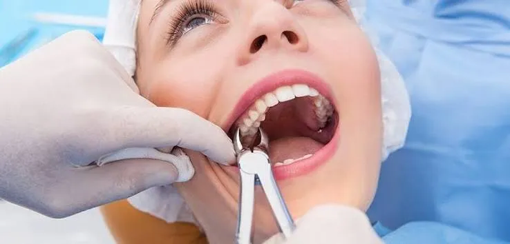 Tooth extraction procedure at Revive Dental, Vajarahalli, Banashankari 6th Stage