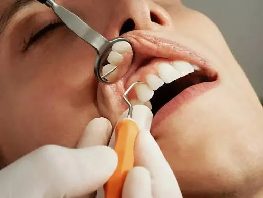 Flap surgery / gum surgery at Revive Dental, Vajarahalli