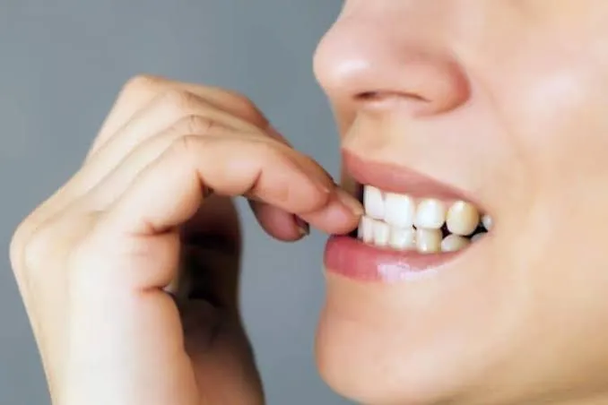 Nail biting habit correction at Revive Dental, Vajarahalli