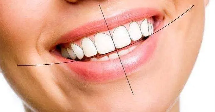 Smile designing consultation at Revive Dental, Vajarahalli, Banashankari 6th Stage
