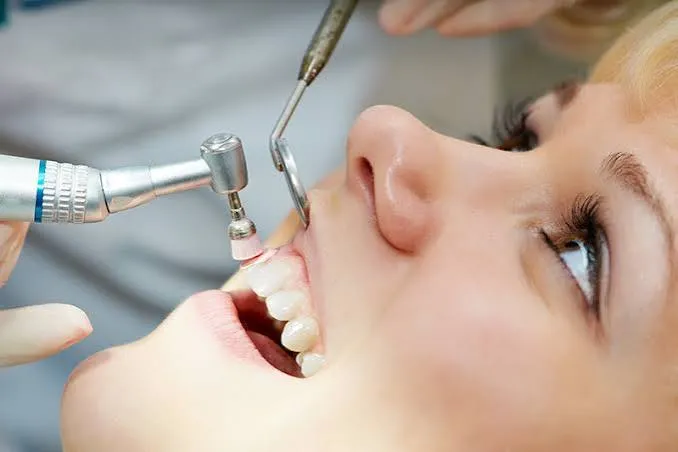 Teeth cleaning and oral prophylaxis for patients from Vajarahalli and Banashankari 6th Stage at Revive Dental