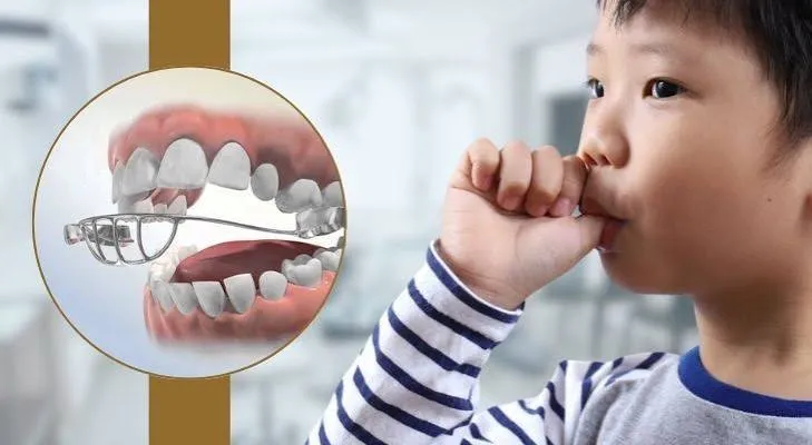 Child guided away from thumb sucking habit near Banashankari 6th Stage