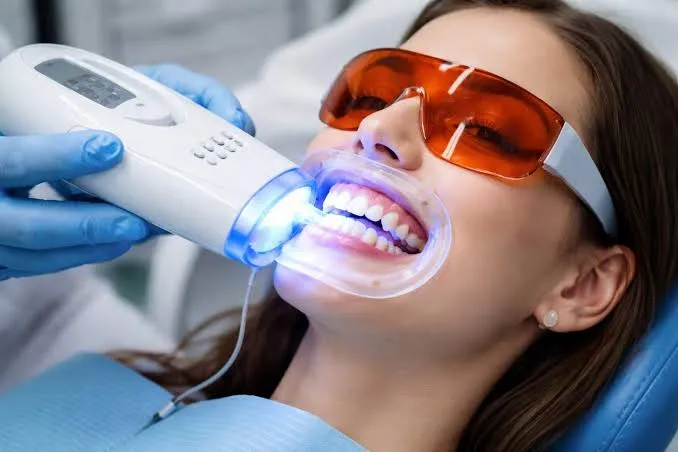 Tooth whitening treatment at Revive Dental, Banashankari 6th Stage