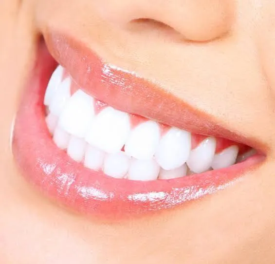 Before and after in-clinic tooth whitening results